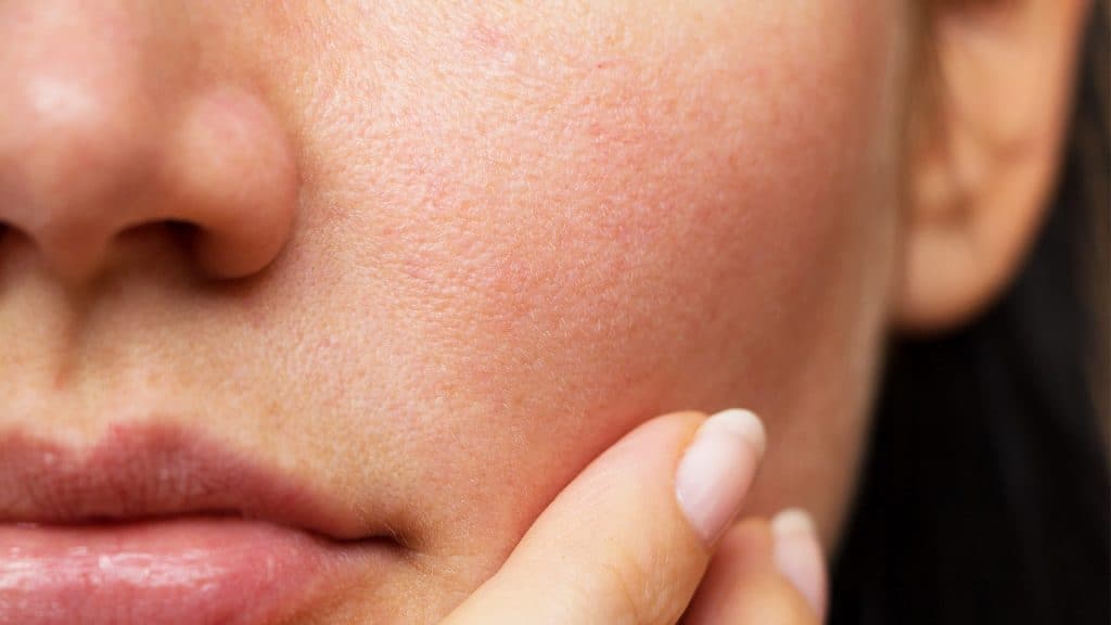 Los mejores consejos de belleza para pieles sensibles